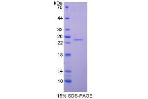 Image no. 1 for Lipocalin 2 (LCN2) (AA 23-199) protein (His tag) (ABIN6239971) (Lipocalin 2 Protein (LCN2) (AA 23-199) (His tag))