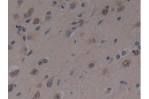 Immunohistochemistry (IHC) image for anti-Mitogen-Activated Protein Kinase Kinase Kinase 1 (MAP3K1) (AA 1307-1509) antibody (ABIN7442936)