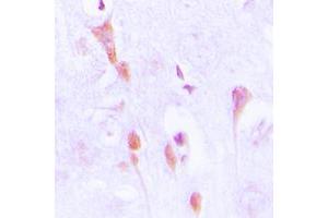 Immunohistochemical analysis of Beta-arrestin-1 (pS412) staining in human brain formalin fixed paraffin embedded tissue section. (beta Arrestin 1 Antikörper  (C-Term, pSer412))