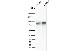 Western Blotting (WB) image for anti-Junction Plakoglobin (JUP) antibody (ABIN6939838)