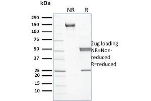 Spectrin beta Chain, Erythrocyte (SPTB) Antikörper