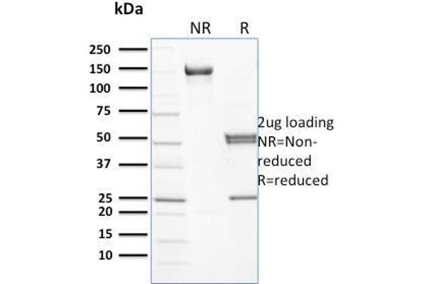 Spectrin beta Chain, Erythrocyte (SPTB) Antikörper