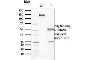 SDS-PAGE Analysis Purified Spectrin beta III Mouse Monoclonal Antibody (RG/26).