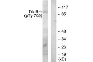 Western blot analysis of extracts from mouse kidney, using Trk B (Phospho-Tyr705) Antibody. (TRKB Antikörper  (pTyr706))