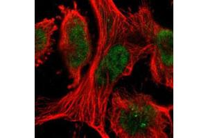 Immunofluorescent staining of U-251 MG with TAF10 polyclonal antibody  (Green) shows positivity in nucleus. (TAF10 Antikörper)