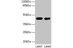 Western blot All lanes: CKB antibody at 2 μg/mL Lane 1: Mouse brain tissue Lane 2: 293T whole cell lysate Secondary Goat polyclonal to rabbit IgG at 1/10000 dilution Predicted band size: 43 kDa Observed band size: 43 kDa (CKB Antikörper  (AA 2-270))