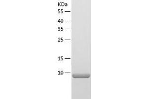 Western Blotting (WB) image for S100 Calcium Binding Protein A1 (S100A1) (AA 1-94) protein (His tag) (ABIN7124943) (S100A1 Protein (AA 1-94) (His tag))