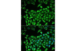 Immunofluorescence analysis of A549 cells using HAS3 antibody. (HAS3 Antikörper  (AA 67-281))