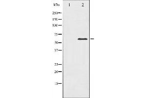 Western blot analysis of PAK1 expression in Etoposide treated 293 whole cell lysates,The lane on the left is treated with the antigen-specific peptide. (PAK1 Antikörper  (Internal Region))