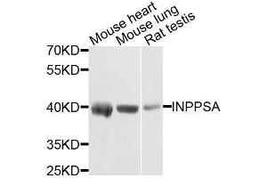 Western blot analysis of extracts of various cell lines, using INPP5A antibody.