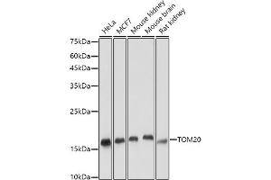 Western blot analysis of extracts of various cell lines, using TOM20 antibody (ABIN7268554) at 1:5000 dilution.