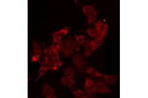 ABIN6274271 staining HuvEc by IF/ICC. (TRAIL Antikörper  (Internal Region))