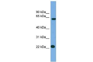 WB Suggested Anti-C21orf45 Antibody Titration:  0. (C21ORF45 Antikörper  (N-Term))