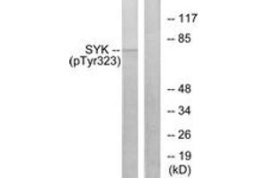 Western blot analysis of extracts from HT29 cells, using SYK (Phospho-Tyr323) Antibody. (SYK Antikörper  (pTyr323))