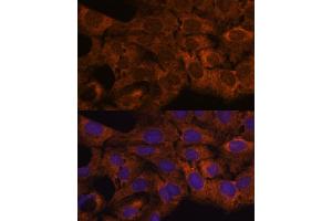 Immunofluorescence analysis of U-2 OS cells using Sec23B antibody (ABIN7270169) at dilution of 1:100.