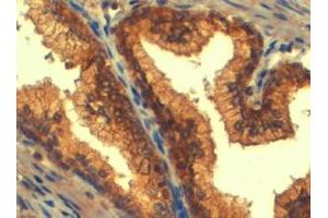 Immunohistochemistry (IHC) image for anti-ATP-Binding Cassette, Sub-Family C (CFTR/MRP), Member 4 (ABCC4) (C-Term) antibody (ABIN185302)