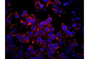 Immunofluorescence (IF) image for anti-Insulin Receptor Substrate 2 (IRS2) (AA 1288-1338) antibody (ABIN7448980)