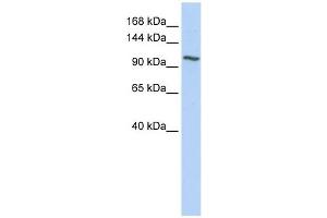 NNT antibody used at 1 ug/ml to detect target protein. (NNT Antikörper  (N-Term))
