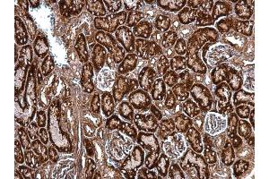 IHC-P Image HSP47 antibody [N2C2], Internal detects HSP47 protein at cytosol on mouse kidney by immunohistochemical analysis. (SERPINH1 Antikörper  (Internal Region))