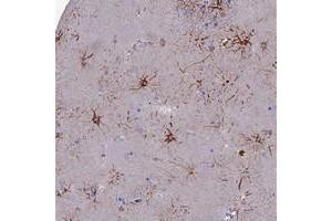 Immunohistochemical staining of human lateral ventricle with CYB561D2 polyclonal antibody  shows strong cytoplasmic positivity in fraction of glial cells. (CYB561D2 Antikörper)