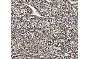 IHC analysis of Liver Carboxylesterase 1/CES1 using anti-Liver Carboxylesterase 1/CES1 antibody (ABIN7602719). (CES1 Antikörper  (AA 99-206))