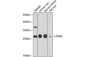Western blot analysis of extracts of various cell lines using ETHE1 Polyclonal Antibody at dilution of 1:1000. (ETHE1 Antikörper)