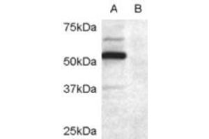 Western Blotting (WB) image for anti-Doublecortin Domain Containing 2 (DCDC2) (Internal Region) antibody (ABIN2465587) (DCDC2 Antikörper  (Internal Region))