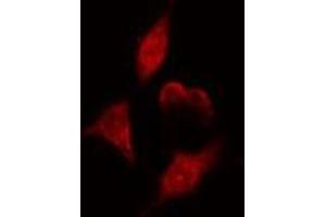 ABIN6275110 staining  HeLa cells by IF/ICC. (NEIL1 Antikörper  (Internal Region))