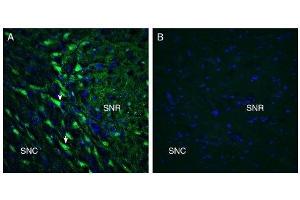 Expression of GPR55 in rat substantia nigra. (GPR55 Antikörper  (Extracellular))