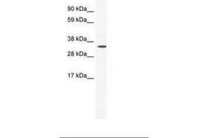 Image no. 1 for anti-Homeobox B1 (HOXB1) (AA 26-75) antibody (ABIN202186) (HOXB1 Antikörper  (AA 26-75))