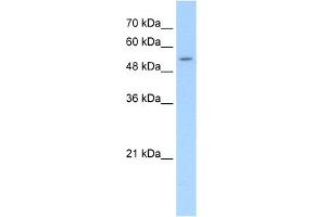 WB Suggested Anti-SLC26A8 Antibody Titration:  5. (SLC26A8 Antikörper  (C-Term))