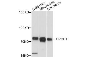 Western blot analysis of extracts of various cell lines, using OVGP1 antibody (ABIN6291552) at 1:3000 dilution. (OVGP1 Antikörper)
