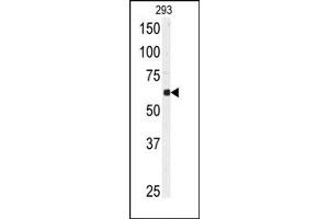 Image no. 1 for anti-Ubiquitin Specific Peptidase 3 (USP3) (N-Term) antibody (ABIN357523) (USP3 Antikörper  (N-Term))