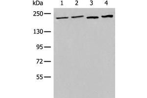 Western blot analysis of 293T cell Human metastatic malignant melanoma tissue lysates using EEA1 Polyclonal Antibody at dilution of 1:700 (EEA1 Antikörper)