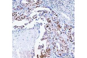IHC analysis of FEN1 using anti-FEN1 antibody (ABIN7601617). (FEN1 Antikörper  (AA 4-300))