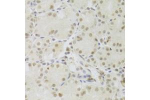 Immunohistochemistry of paraffin-embedded human stomach using PRPF3 Antibody (ABIN5973192) at dilution of 1/100 (40x lens). (PRPF3 Antikörper)