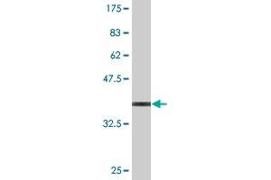 Western Blot detection against Immunogen (36. (RAG2 Antikörper  (AA 428-527))