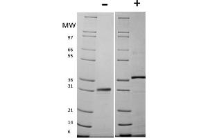 SDS-PAGE of Mouse Follistatin Recombinant Protein SDS-PAGE of Mouse Follistatin Recombinant Protein.