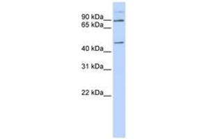 Image no. 1 for anti-Leber Congenital Amaurosis 5-Like (LCA5L) (C-Term) antibody (ABIN6740943) (LCA5L Antikörper  (C-Term))