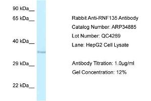 WB Suggested Anti-RNF135 Antibody   Titration: 1. (RNF135 Antikörper  (Middle Region))