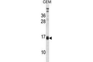 Western blot analysis in CEM cell line lysates (35ug/lane) using LALBA  Antibody .