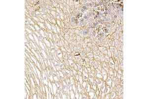 Immunohistochemistry of paraffin-embedded Human esophagus using S100 antibody (ABIN7270123) at dilution of 1:25 (40x lens). (S100A10 Antikörper  (AA 1-97))