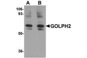 Western blot analysis of GOLPH2 in rat brain tissue lysate with AP30371PU-N GOLPH2 antibody at (A) 0. (GOLM1 Antikörper  (Center))