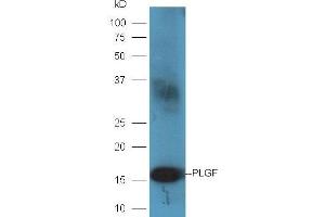 Rat placenta lysates probed with Rabbit Anti-PLGF Polyclonal Antibody, Unconjugated (ABIN727220) at 1:300 overnight at 4 °C. (PLGF Antikörper  (AA 101-158))