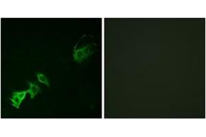 Immunofluorescence (IF) image for anti-C-Abl Oncogene 1, Non-Receptor tyrosine Kinase (ABL1) (pTyr393) antibody (ABIN2888351) (ABL1 Antikörper  (pTyr393))