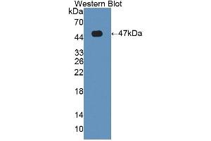 Western blot analysis of the recombinant protein. (HFE2 Antikörper  (AA 36-200))