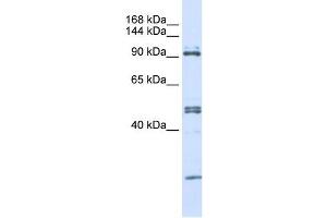 AARS antibody used at 1 ug/ml to detect target protein. (AARS Antikörper  (N-Term))