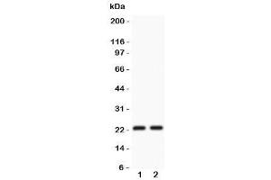 Western blot testing of CD3 epsilon antibody and Lane 1:  Jurkat (CD3 epsilon Antikörper  (AA 23-207))