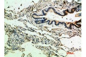 Immunohistochemical analysis of paraffin-embedded human-lung, antibody was diluted at 1:200 (THBS4 Antikörper  (AA 551-600))