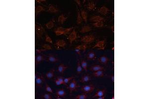 Immunofluorescence analysis of C6 cells using SLC25 antibody (ABIN6132661, ABIN6147921, ABIN6147922 and ABIN6215721) at dilution of 1:100. (SLC25A24 Antikörper  (AA 1-200))